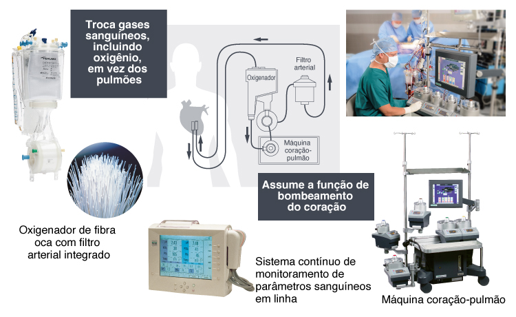 Sistema de Bypass Cardiopulmonar