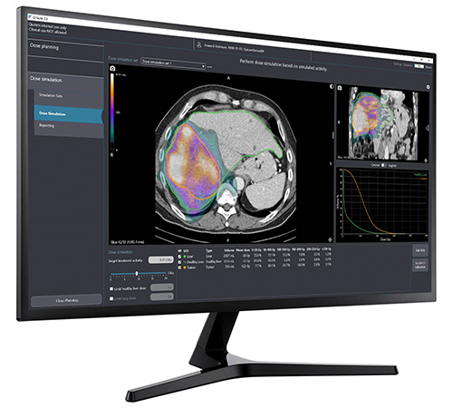 Imaging in treatment planning software 