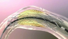 Drug-eluting coronary stents